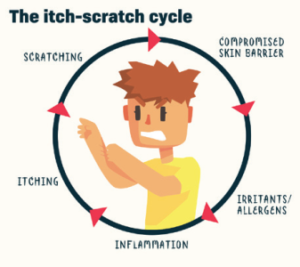 Itch-scratch cycle in eczema